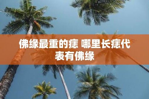 佛缘最重的痣 哪里长痣代表有佛缘