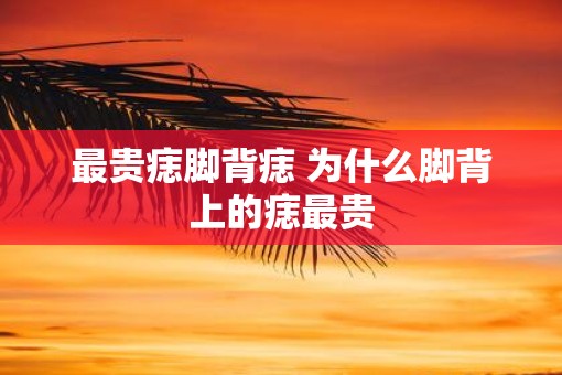 最贵痣脚背痣 为什么脚背上的痣最贵