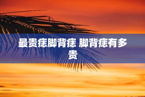 最贵痣脚背痣 脚背痣有多贵