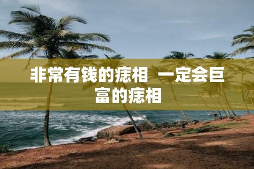 非常有钱的痣相  一定会巨富的痣相