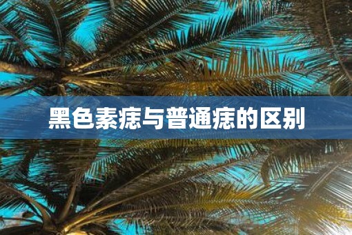 黑色素痣与普通痣的区别