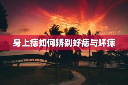 身上痣如何辨别好痣与坏痣