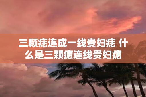 三颗痣连成一线贵妇痣 什么是三颗痣连线贵妇痣