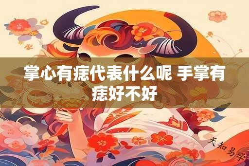 掌心有痣代表什么呢 手掌有痣好不好