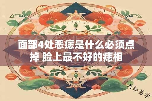 面部4处恶痣是什么必须点掉 脸上最不好的痣相