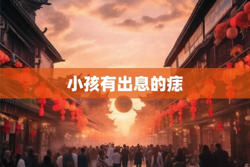 小孩有出息的痣 小孩有出息的痣
