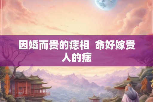 因婚而贵的痣相  命好嫁贵人的痣