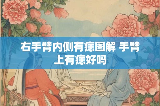 右手臂内侧有痣图解 手臂上有痣好吗