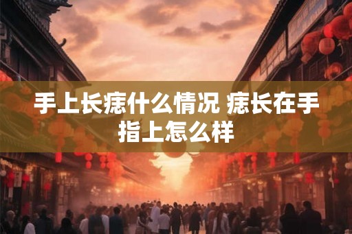 手上长痣什么情况 痣长在手指上怎么样