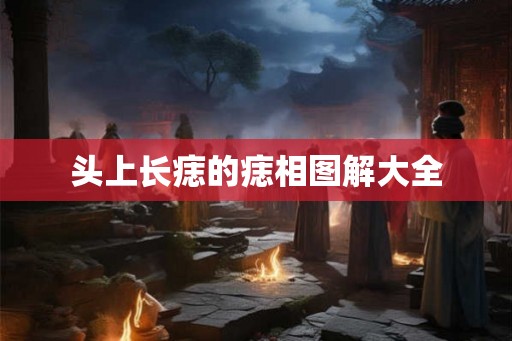 头上长痣的痣相图解大全
