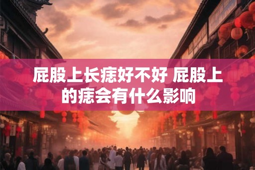 屁股上长痣好不好 屁股上的痣会有什么影响 屁股上长痣好不好 屁股上的痣会有什么影响