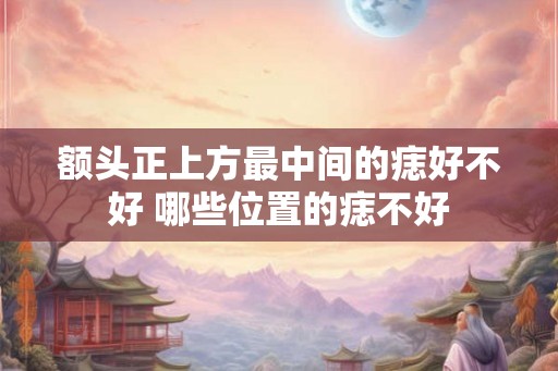 额头正上方最中间的痣好不好 哪些位置的痣不好