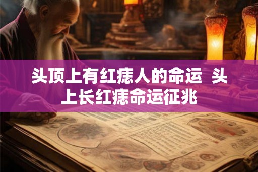 头顶上有红痣人的命运  头上长红痣命运征兆