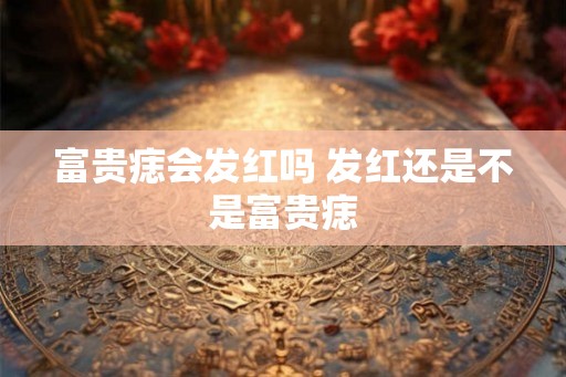 富贵痣会发红吗 发红还是不是富贵痣