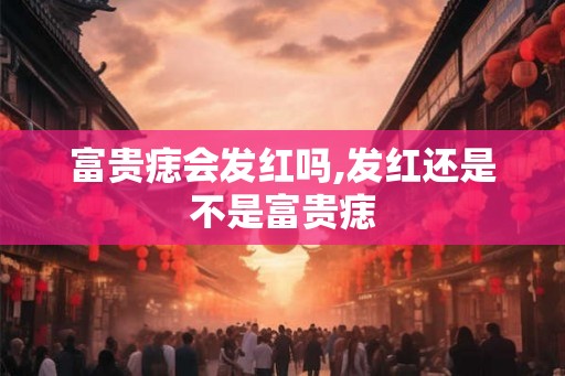 富贵痣会发红吗,发红还是不是富贵痣